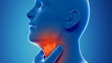 عوارض لارنژیت رفلاکس